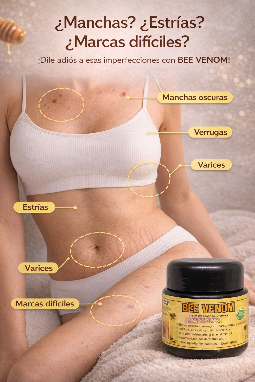 Bee Venom Premium. Crema Reparadora Intensiva de Veneno de Abeja. Aclara, hidrata y revitaliza tu piel mientras ayuda a disminuir manchas, cicatrices, estrías y várices superficiales.